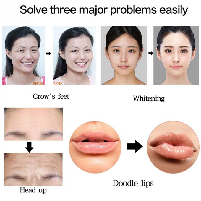 arma ácida hialurónica de alta pressão de 0.3ml Hyaluron Pen Lip Filler Injection Atomizer Pen No Needle Mesotherapy para a remoção do enrugamento - compra a preço de $43,20 em aliexpress.com | imall.com