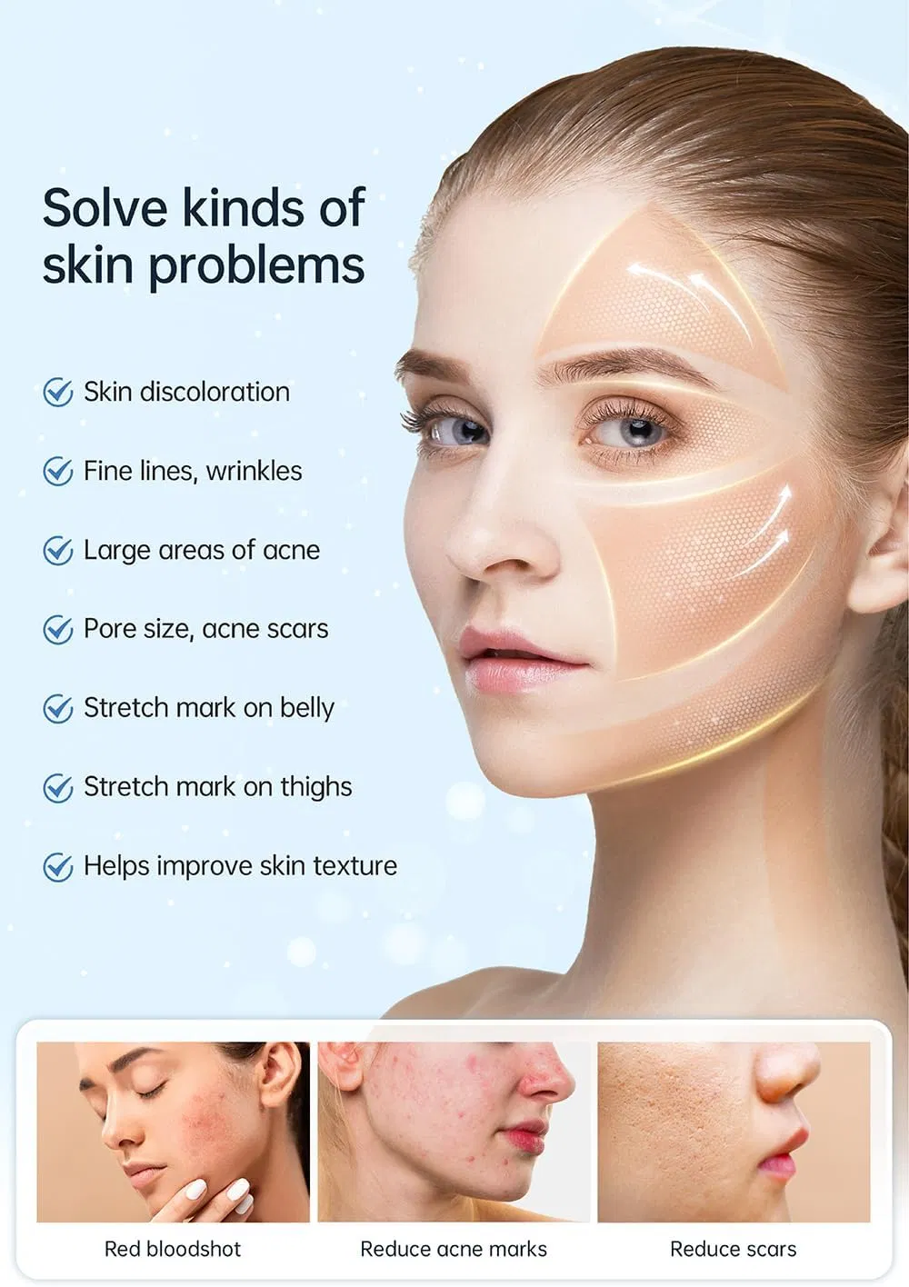 Novo Hydra Pen H5 Serum EMS e Microneedling para aplicação automática 4