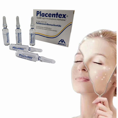 3 ml de enchimentos dérmicos de poli-desoxi-ribo-nucleotídeo para cicatrizes de acne